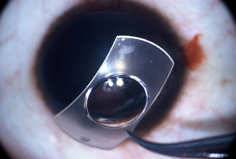 Clinique Ophtalmologique Lamartine