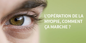 Comment marche l'opération de la myopie